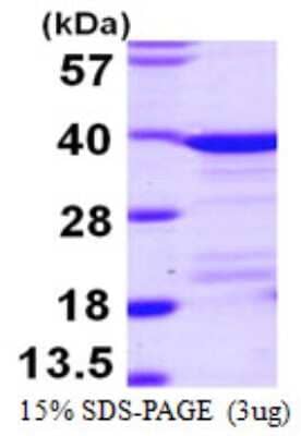 SDS-PAGE: Recombinant Human EEF1D His Protein [NBP1-51028]