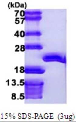 SDS-PAGE: Recombinant Human EEF1E1 His Protein [NBP1-51088]