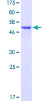 SDS-PAGE: Recombinant Human EFHD2 GST (N-Term) Protein [H00079180-P01]