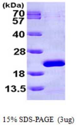 SDS-PAGE: Recombinant Human EIF1AX His Protein [NBP1-48391]