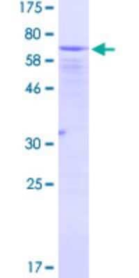 SDS-PAGE: Recombinant Human EIF2 beta GST (N-Term) Protein [H00008894-P01]