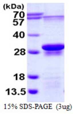 SDS-PAGE: Recombinant Human EIF3J His Protein [NBP1-72511]