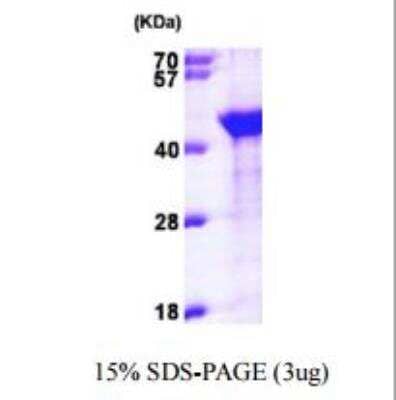 SDS-PAGE: Recombinant Human EMAP-II/AIMP1 His Protein [NBP1-50936]