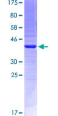 SDS-PAGE: Recombinant Human EMILIN2 GST (N-Term) Protein [H00084034-Q01]