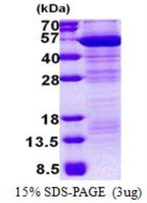 SDS-PAGE: Recombinant Human EMP/MAEA His Protein [NBP2-23208]