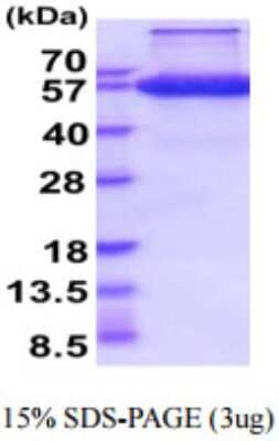 SDS-PAGE: Recombinant Human EPCR hIgG-His Protein [NBP2-59896]