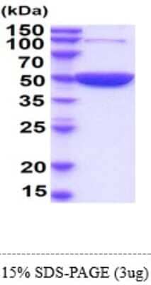 SDS-PAGE: Recombinant Mouse Enolase 1 His Protein [NBP2-61192]