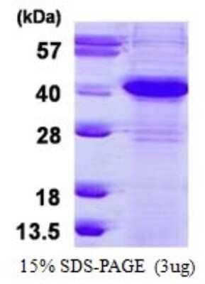 SDS-PAGE: Recombinant Human ERCC1 His Protein [NBP1-98981]