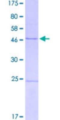 SDS-PAGE: Recombinant Human ERCC8 GST (N-Term) Protein [H00001161-P01]