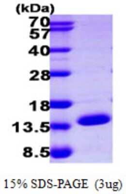 SDS-PAGE: Recombinant Human ERH His Protein [NBP1-51008]