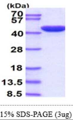 SDS-PAGE: Recombinant Human ERK2 His Protein [NBP1-30309]