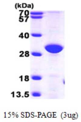 SDS-PAGE: Recombinant Human ERP27 His Protein [NBP1-50913]