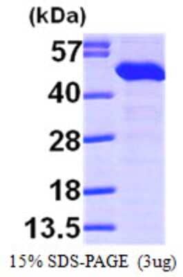 SDS-PAGE: Recombinant Human ERP44 His Protein [NBP1-48324]