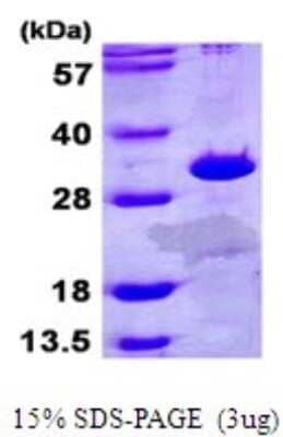 SDS-PAGE: Recombinant Human ETFB His Protein [NBP1-72295]