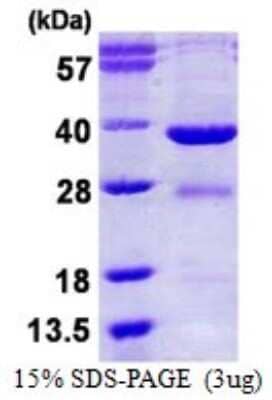 SDS-PAGE: Recombinant Human EYA2 His Protein [NBP1-99047]