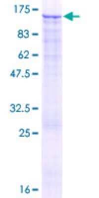 SDS-PAGE: Recombinant Human EZH2/KMT6 GST (N-Term) Protein [H00002146-P01]