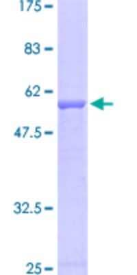 SDS-PAGE: Recombinant Human Elastase GST (N-Term) Protein [H00023436-P02]