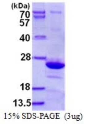 SDS-PAGE: Recombinant Human Endomucin/Mucin -14 His Protein [NBP1-98900]