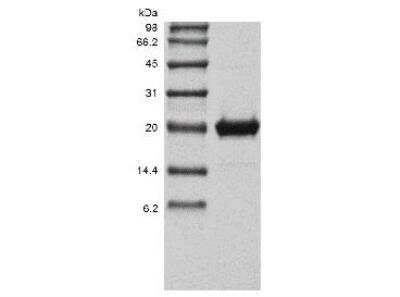 SDS-PAGE: Recombinant Human Endostatin Protein [NBP2-34974]