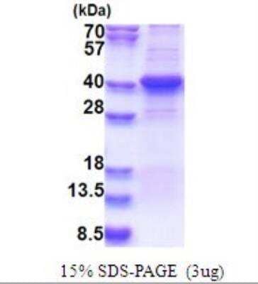 SDS-PAGE: Recombinant Human Endothelial Lipase His Protein [NBP2-51639]