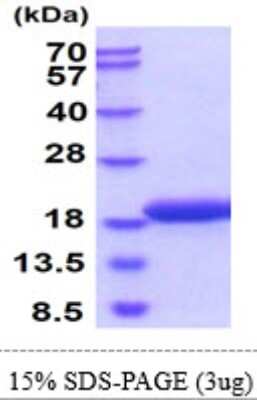 SDS-PAGE: Recombinant Mouse gamma-Synuclein His Protein [NBP2-61179]