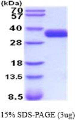 SDS-PAGE: Recombinant Human EpCAM/TROP1 His Protein [NBP2-52190]