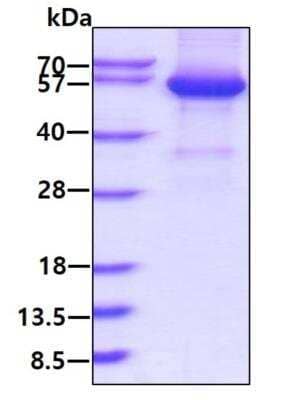 SDS-PAGE: Recombinant Human Ephrin-A3 hIgG-His Protein [NBP2-77495]