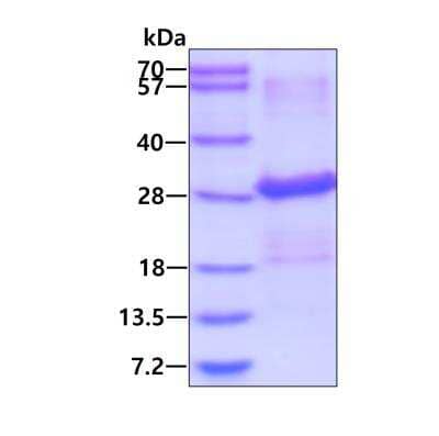 SDS-PAGE: Recombinant Human Ephrin-B2 His Protein [NBP1-72462]