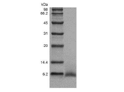 SDS-PAGE: Recombinant Human Epiregulin Protein [NBP2-34989]