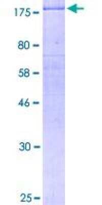 SDS-PAGE: Recombinant Human ErbB2/Her2 GST (N-Term) Protein [H00002064-P01]