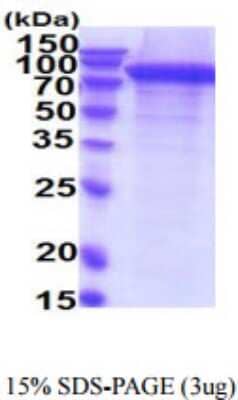 SDS-PAGE: Recombinant Human ErbB2/Her2 His Protein [NBP2-59653]