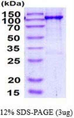 SDS-PAGE: Recombinant Human ErbB3/Her3 hIgG-His Protein [NBP2-52128]