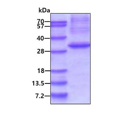 SDS-PAGE: Recombinant Human Exosome component 4 His Protein [NBP2-23032]