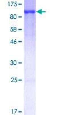 SDS-PAGE: Recombinant Human Ezrin GST (N-Term) Protein [H00007430-P02]