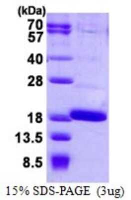 SDS-PAGE: Recombinant Human FABP12 His Protein [NBP1-98969]