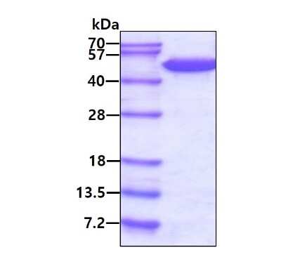 SDS-PAGE: Recombinant Human FADD GST (N-Term) Protein [NBC1-18513]