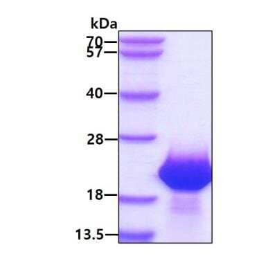 SDS-PAGE: Recombinant Human FAM107B His Protein [NBP2-23033]