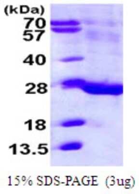 SDS-PAGE: Recombinant Human FAM3C His Protein [NBP1-72492]