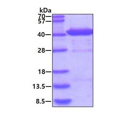 SDS-PAGE: Recombinant Human FBPase 1 His Protein [NBP1-30268]