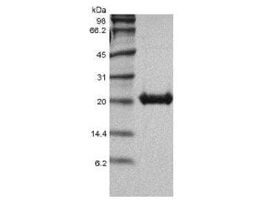 SDS-PAGE: Recombinant Human FGF-16 Protein [NBP2-61311]