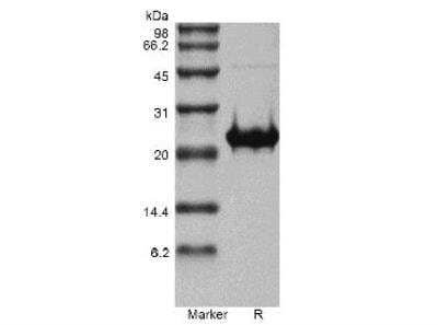 SDS-PAGE: Recombinant Human FGF-17 Protein [NBP2-61312]