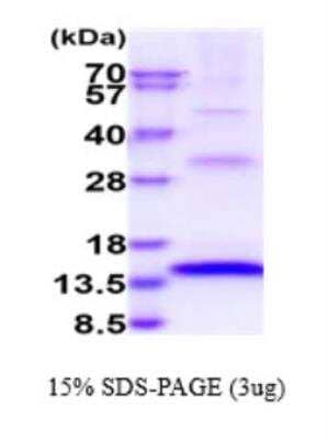 SDS-PAGE: Recombinant Human FGF-23 His Protein [NBP2-77508]