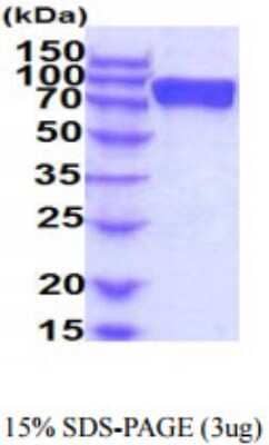SDS-PAGE: Recombinant Human FGFR2 hIgG-His Protein [NBP2-59905]