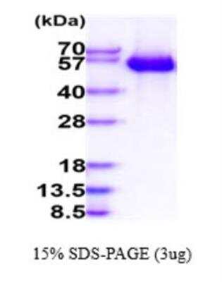 SDS-PAGE: Recombinant Human FGFR1 His Protein [NBP2-77504]