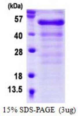 SDS-PAGE: Recombinant Human FGFR1OP His Protein [NBP1-98963]