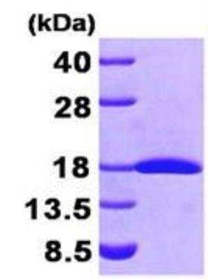 SDS-PAGE: Recombinant Human FHIT His Protein [NBP1-44387]