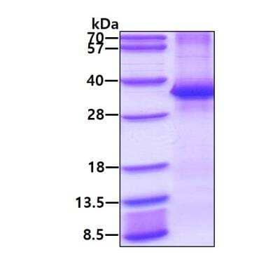 SDS-PAGE: Recombinant Human FHL2 His Protein [NBP2-51868]