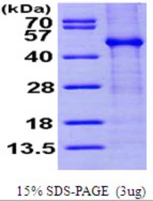 SDS-PAGE: Recombinant Human FKBPL His Protein [NBP1-50839]