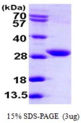 SDS-PAGE: Recombinant Human FVT1 His Protein [NBP1-51022]