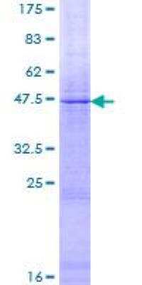 SDS-PAGE: Recombinant Human Factor VIII GST (N-Term) Protein [H00002157-P01]